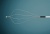 Одноразовые корзинки для ERCP